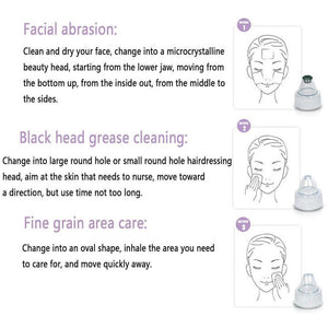 Beauty Health Electric Blackhead Remover Vacuum